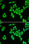 Adenylosuccinate Lyase antibody, STJ28200, St John