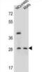 Spermatogenesis Associated Serine Rich 1 antibody, abx026463, Abbexa, Western Blot image 