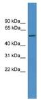 Tweety Family Member 3 antibody, GTX35188, GeneTex, Western Blot image 