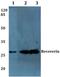 Recoverin antibody, A06882-1, Boster Biological Technology, Western Blot image 