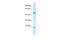 Protein Zfp113 antibody, A30337, Boster Biological Technology, Western Blot image 