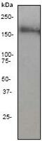 DNA Topoisomerase II Alpha antibody, ab52934, Abcam, Western Blot image 