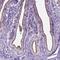 AP-5 complex subunit beta-1 antibody, NBP2-49460, Novus Biologicals, Immunohistochemistry paraffin image 