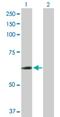 Chaperonin Containing TCP1 Subunit 6B antibody, H00010693-D01P, Novus Biologicals, Western Blot image 