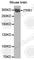 Inositol 1,4,5-Trisphosphate Receptor Type 1 antibody, A0863, ABclonal Technology, Western Blot image 