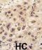 G Protein Nucleolar 3 antibody, abx027775, Abbexa, Immunohistochemistry paraffin image 