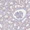 Immunoglobulin superfamily member 5 antibody, NBP2-34155, Novus Biologicals, Immunohistochemistry paraffin image 