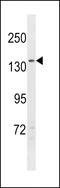 NPC1 Like Intracellular Cholesterol Transporter 1 antibody, LS-C158000, Lifespan Biosciences, Western Blot image 