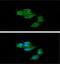 Short-chain specific acyl-CoA dehydrogenase, mitochondrial antibody, GTX57702, GeneTex, Immunocytochemistry image 
