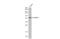 Farnesyl-Diphosphate Farnesyltransferase 1 antibody, GTX108885, GeneTex, Western Blot image 