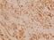 FA Complementation Group D2 antibody, A00563-1, Boster Biological Technology, Immunohistochemistry paraffin image 