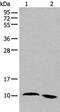 Neuronal Regeneration Related Protein antibody, PA5-68426, Invitrogen Antibodies, Western Blot image 