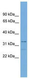 Transcription Elongation Factor A2 antibody, TA341818, Origene, Western Blot image 