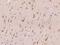 Derlin 1 antibody, 201516-T10, Sino Biological, Immunohistochemistry paraffin image 