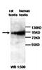 DGCR8 Microprocessor Complex Subunit antibody, orb77291, Biorbyt, Western Blot image 