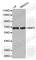 Matrix Metallopeptidase 2 antibody, A2454, ABclonal Technology, Western Blot image 