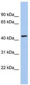 Potassium Channel Tetramerization Domain Containing 10 antibody, TA338718, Origene, Western Blot image 