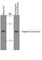 Proprotein Convertase Subtilisin/Kexin Type 9 antibody, PA5-47559, Invitrogen Antibodies, Western Blot image 