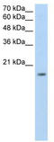 Zinc Finger Protein 580 antibody, TA345196, Origene, Western Blot image 