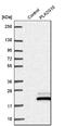 Phospholipase A2 Group X antibody, NBP1-93706, Novus Biologicals, Western Blot image 