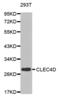 C-Type Lectin Domain Family 4 Member D antibody, abx002061, Abbexa, Western Blot image 