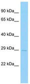 Transmembrane Protein 86A antibody, TA337969, Origene, Western Blot image 