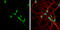 Leucine-rich glioma-inactivated protein 1 antibody, GTX105700, GeneTex, Immunocytochemistry image 