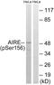 Autoimmune Regulator antibody, PA5-37475, Invitrogen Antibodies, Western Blot image 