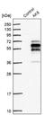 Adenylate Kinase 8 antibody, NBP1-88244, Novus Biologicals, Western Blot image 