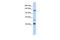 Potassium Voltage-Gated Channel Subfamily H Member 3 antibody, GTX47445, GeneTex, Western Blot image 