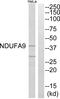 NADH dehydrogenase [ubiquinone] 1 alpha subcomplex subunit 9, mitochondrial antibody, PA5-39270, Invitrogen Antibodies, Western Blot image 