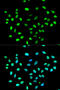 Heterogeneous Nuclear Ribonucleoprotein K antibody, A01793, Boster Biological Technology, Western Blot image 
