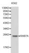 RAB7A, Member RAS Oncogene Family antibody, abx001068, Abbexa, Western Blot image 