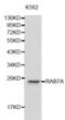 RAB7A antibody, abx001068, Abbexa, Western Blot image 