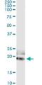 Interleukin 17B antibody, H00050604-M01, Novus Biologicals, Immunoprecipitation image 