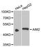 Absent In Melanoma 2 antibody, STJ22558, St John