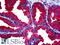 Matrix Metallopeptidase 13 antibody, LS-B5183, Lifespan Biosciences, Immunohistochemistry frozen image 