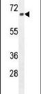 Zinc Finger Protein 169 antibody, PA5-24010, Invitrogen Antibodies, Western Blot image 