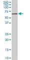 Receptor Interacting Serine/Threonine Kinase 2 antibody, H00008767-M03, Novus Biologicals, Western Blot image 