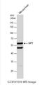 Glutamic--Pyruvic Transaminase antibody, NBP1-31525, Novus Biologicals, Western Blot image 