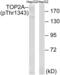 DNA Topoisomerase II Alpha antibody, abx012641, Abbexa, Western Blot image 