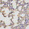 Protein Kinase CAMP-Activated Catalytic Subunit Beta antibody, LS-C333984, Lifespan Biosciences, Immunohistochemistry frozen image 