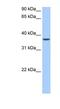 AlkB Homolog 8, TRNA Methyltransferase antibody, NBP1-80473, Novus Biologicals, Western Blot image 