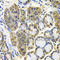 Amyloid Beta Precursor Protein Binding Family B Member 1 antibody, A1944, ABclonal Technology, Immunohistochemistry paraffin image 