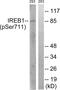 Aconitase 1 antibody, PA5-38636, Invitrogen Antibodies, Western Blot image 