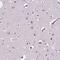 Zinc Finger Protein 572 antibody, NBP2-39077, Novus Biologicals, Immunohistochemistry frozen image 