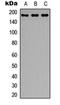 Insulin Receptor Substrate 1 antibody, orb315570, Biorbyt, Western Blot image 