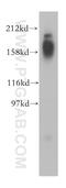 NPC Intracellular Cholesterol Transporter 1 antibody, 13926-1-AP, Proteintech Group, Western Blot image 