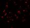 PHD Finger Protein 14 antibody, GTX32120, GeneTex, Immunofluorescence image 
