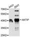 AKT Interacting Protein antibody, A11822, ABclonal Technology, Western Blot image 